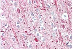 Anti-Androgen Receptor antibody IHC staining of human brain, cortex. (Androgen Receptor antibody  (AA 621-670))