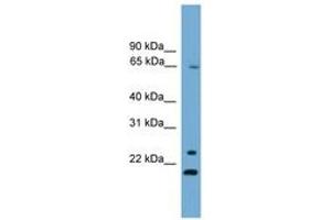 Image no. 1 for anti-Zinc Finger Protein 37A (ZNF37A) (AA 331-380) antibody (ABIN6745538)