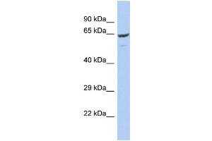 Host: Rabbit Target Name: FBXO21 Sample Type: OVCAR-3 Whole Cell lysates Antibody Dilution: 1. (FBXO21 antibody  (C-Term))