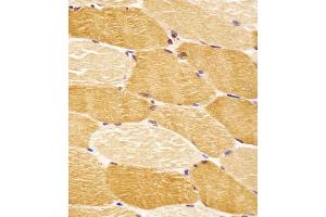 (ABIN6243301 and ABIN6578652) staining SLC29A2 in human skeletal muscle tissue sections by Immunohistochemistry (IHC-P - paraformaldehyde-fixed, paraffin-embedded sections). (SLC29A2 antibody  (AA 1-31))