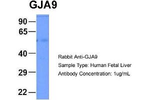 Host: Rabbit Target Name: GJA9 Sample Type: Human Fetal Liver Antibody Dilution: 1. (GJA9 antibody  (Middle Region))