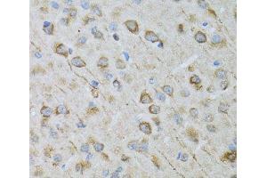 Immunohistochemistry of paraffin-embedded Rat brain using CRYM Polyclonal Antibody at dilution of 1:100 (40x lens). (CRYM antibody)