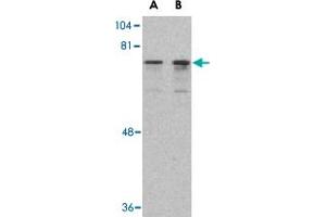 Western blot analysis of DDX3X in HepG2 cell lysate with DDX3X polyclonal antibody  at (A) 0. (DDX3X antibody  (N-Term))