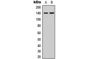 Western blot analysis of p140 Cap expression in HEK293T (A), HeLa (B) whole cell lysates. (SRCIN1 antibody  (Center))