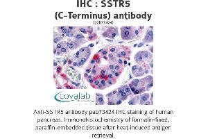 Image no. 1 for anti-Somatostatin Receptor 5 (SSTR5) (C-Term) antibody (ABIN1739677) (SSTR5 antibody  (C-Term))