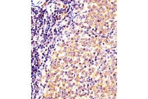 (ABIN6243917 and ABIN6577996) staining (Mouse) Nr4a2 in mouse spleen sections by Immunohistochemistry (IHC-P - paraformaldehyde-fixed, paraffin-embedded sections). (NR4A2 antibody  (AA 164-197))