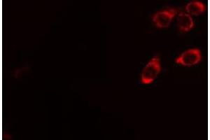 ABIN6267436 staining Hela cells by IF/ICC. (CBL antibody  (pTyr674))