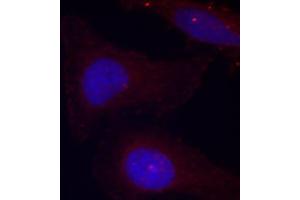 Immunofluorescence staining of methanol-fixed HeLa cells using Phospho-PTK2B-Y402 antibody (ABIN2987623). (PTK2B antibody  (pTyr402))