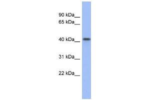 WB Suggested Anti-FIZ1 Antibody Titration: 0. (FIZ1 antibody  (Middle Region))