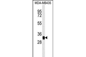 MTCH2 Antibody (N-term) (ABIN651683 and ABIN2840360) western blot analysis in MDA-M cell line lysates (35 μg/lane). (MTCH2 antibody  (N-Term))