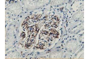 Immunohistochemical staining of paraffin-embedded Human Kidney tissue using anti-ADIPOQ mouse monoclonal antibody. (ADIPOQ antibody  (AA 19-244))