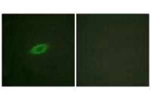 Immunofluorescence analysis of HeLa cells, treated with Forskolin (40nM, 30 mins), using Annexin A6 antibody. (ANXA6 antibody)