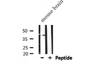 Western blot analysis of GAP43 expression in Mouse brain lysate (GAP43 antibody  (C-Term))