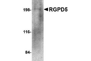 Western Blotting (WB) image for anti-RANBP2-Like and GRIP Domain Containing 5 (RGPD5) (N-Term) antibody (ABIN1031536) (RGPD5 antibody  (N-Term))