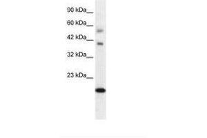 Image no. 2 for anti-BolA-like Protein 1 (BOLA1) (AA 24-73) antibody (ABIN6735869) (BOLA1 antibody  (AA 24-73))