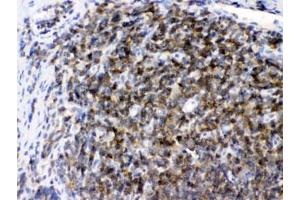 IHC testing of FFPE rat lymph tissue with ARHGEF1 antibody at 1ug/ml. (ARHGEF1 antibody  (AA 41-71))