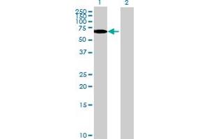Western Blot analysis of TULP2 expression in transfected 293T cell line by TULP2 MaxPab polyclonal antibody. (TULP2 antibody  (AA 1-520))