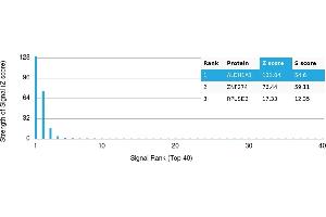 Protein Array (PAr) image for anti-Aldehyde Dehydrogenase 1 Family, Member A1 (ALDH1A1) antibody (ABIN7456135)