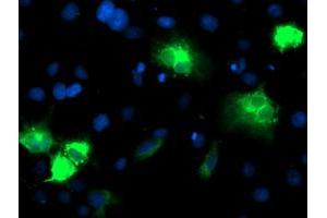 Image no. 2 for anti-Cytochrome P450, Family 2, Subfamily A, Polypeptide 6 (CYP2A6) antibody (ABIN1497722) (CYP2A6 antibody)