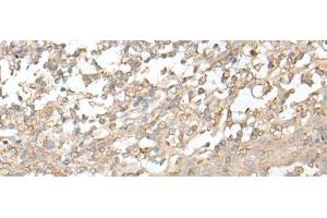 Immunohistochemistry of paraffin-embedded Human tonsil tissue using ZZZ3 Polyclonal Antibody at dilution of 1:50(x200) (ZZZ3 antibody)