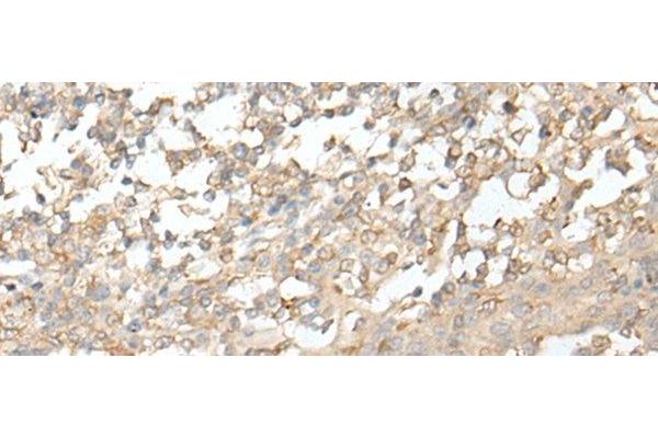 ZZZ3 antibody