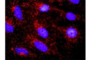 Proximity Ligation Analysis of protein-protein interactions between CTNNA3 and CTNNB1. (CTNNA3 antibody  (AA 1-516))