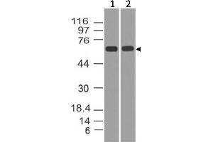 Image no. 1 for anti-Tumor Protein P73 (TP73) antibody (ABIN5027772) (Tumor Protein p73 antibody)