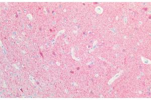 Immunohistochemistry (IHC) image for anti-Ubiquitin Carboxyl-terminal Esterase L1 (Ubiquitin Thiolesterase) (UCHL1) (AA 58-68) antibody (ABIN571206)