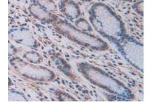 IHC-P analysis of Human Stomach Tissue, with DAB staining. (LOXL2 antibody  (AA 544-751))