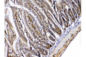 Immunohistochemistry (IHC) image for anti-Mediator Complex Subunit 4 (MED4) (AA 27-140) antibody (ABIN5519029)