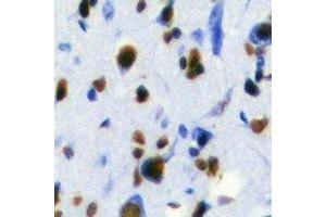 Immunohistochemistry (IHC) image for anti-RAB3A Interacting Protein (Rabin3) (RAB3IP) antibody (ABIN7308252) (RAB3IP antibody)
