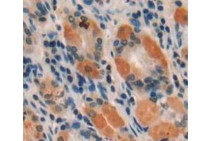 Used in DAB staining on fromalin fixed paraffin-embedded stomach tissue (Intrinsic Factor antibody  (AA 198-413))