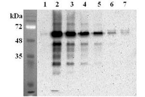 Immunoprecipitation confirmed by recombinant mouse FTO. (FTO antibody)