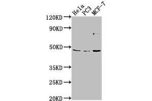 Western Blot Positive WB detected in: Hela whole cell lysate, PC-3 whole cell lysate, MCF-7 whole cell lysate All lanes: TMEM237 antibody at 1:2000 Secondary Goat polyclonal to rabbit IgG at 1/50000 dilution Predicted band size: 46, 45, 49, 36, 47 kDa Observed band size: 46 kDa (TMEM237 antibody  (AA 59-78))
