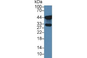 Western Blotting (WB) image for anti-Solute Carrier Family 9 (Sodium/hydrogen Exchanger), Member 3 Regulator 2 (SLC9A3R2) (AA 56-337) antibody (ABIN7442744)