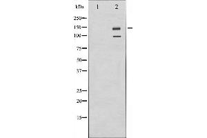 Western blot analysis of IGF1R expression in A549 whole cell lysates,The lane on the left is treated with the antigen-specific peptide. (IGF1R antibody  (C-Term))