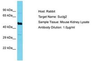 Image no. 1 for anti-Succinate-CoA Ligase, GDP-Forming, beta Subunit (SUCLG2) (AA 101-150) antibody (ABIN6750537) (SUCLG2 antibody  (AA 101-150))