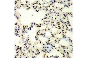 Immunohistochemistry of paraffin-embedded rat lung using SUMO2 antibody (ABIN6128719, ABIN6148726, ABIN6148728 and ABIN6218594) at dilution of 1:100 (40x lens). (SUMO2 antibody  (AA 1-95))