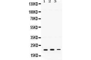Anti-GTPase HRAS antibody, Western blotting All lanes: Anti GTPase HRAS  at 0.