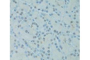 Immunohistochemistry of paraffin-embedded Rat pancreas using GTF2H2C Polyclonal Antibody at dilution of 1:100 (40x lens). (GTF2H2C antibody)