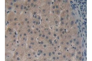 Detection of HMGCS in Human Liver Tissue using Polyclonal Antibody to Hydroxymethylglutaryl Coenzyme A Synthase (HMGCS) (HMGCS1 antibody  (AA 293-467))