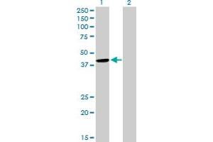 Western Blot analysis of CYTH2 expression in transfected 293T cell line by CYTH2 MaxPab polyclonal antibody. (Cytohesin 2 antibody  (AA 1-400))