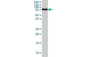 GALNT6 monoclonal antibody (M01), clone 4C10 Western Blot analysis of GALNT6 expression in A-431 .
