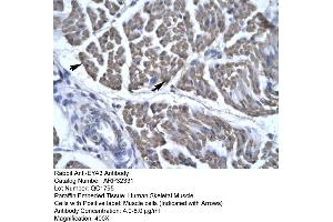 Human Skeletal Muscle (EYA3 antibody  (Middle Region))