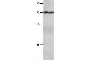 Western Blot analysis of Hela cell using IGF2BP1 Polyclonal Antibody at dilution of 1:750 (IGF2BP1 antibody)