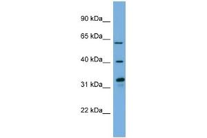 WB Suggested Anti-FMO3 Antibody Titration:  0. (FMO3 antibody  (N-Term))