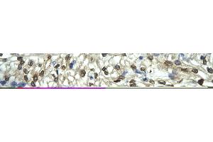 Rabbit Anti-FLI1 Antibody       Paraffin Embedded Tissue:  Human cardiac cell   Cellular Data:  Epithelial cells of renal tubule  Antibody Concentration:   4. (FLI1 antibody  (Middle Region))