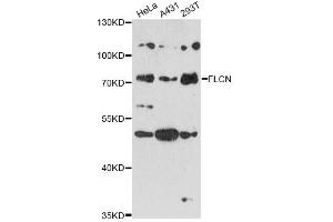 Western blot analysis of extracts of various cell lines, using FLCN antibody (ABIN6294212) at 1:3000 dilution.