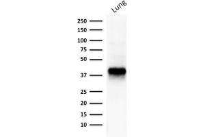Western Blotting (WB) image for anti-Epithelial Cell Adhesion Molecule (EPCAM) (AA 77-202), (Extracellular Domain) antibody (ABIN6939978)