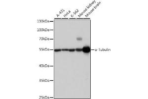 Western blot analysis of extracts of various cell lines, using α-Tubulin antibody (ABIN3020549, ABIN3020550 and ABIN3020551) at 1:1000 dilution. (TUBA4A antibody  (AA 1-180))
